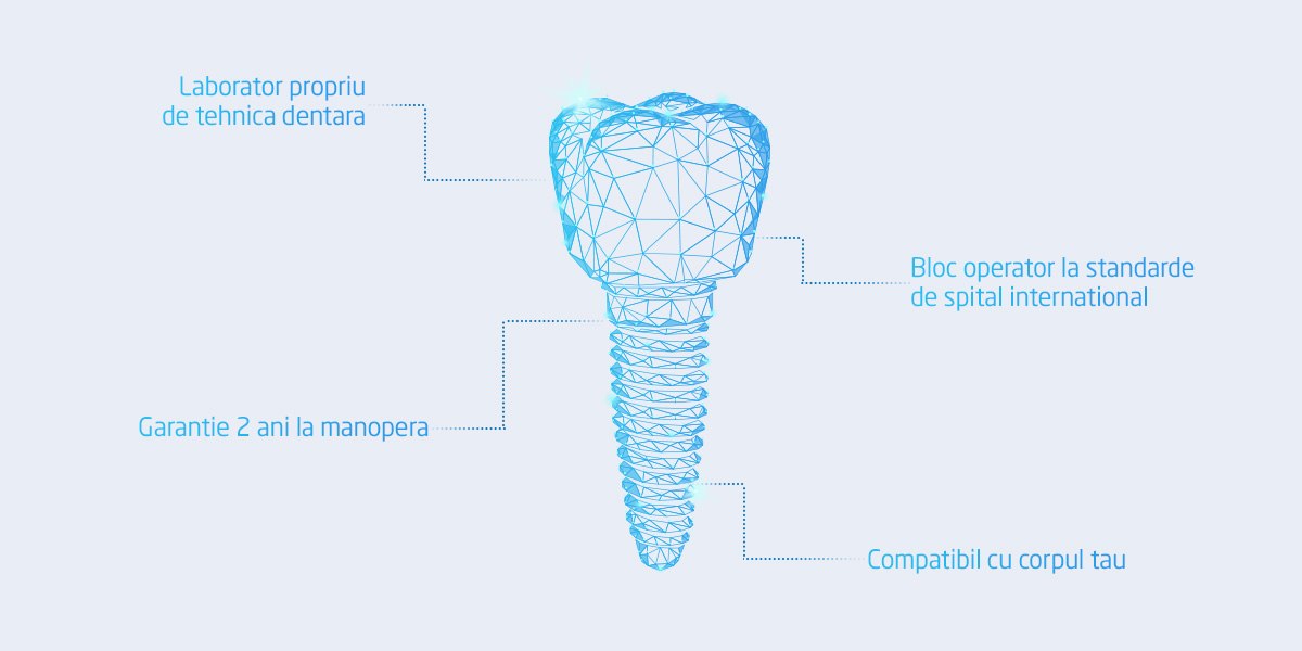 implant dentar