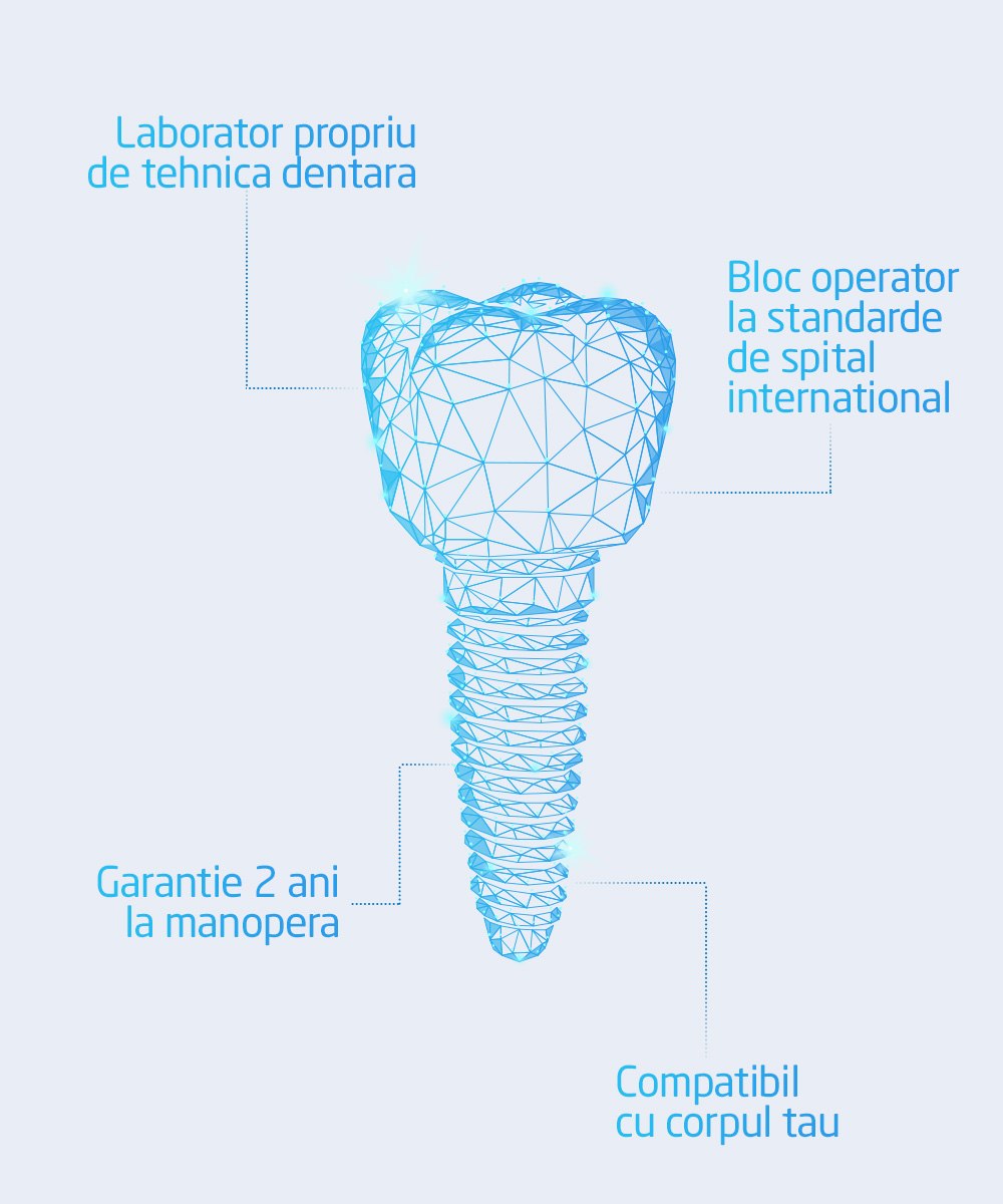 implant dentar