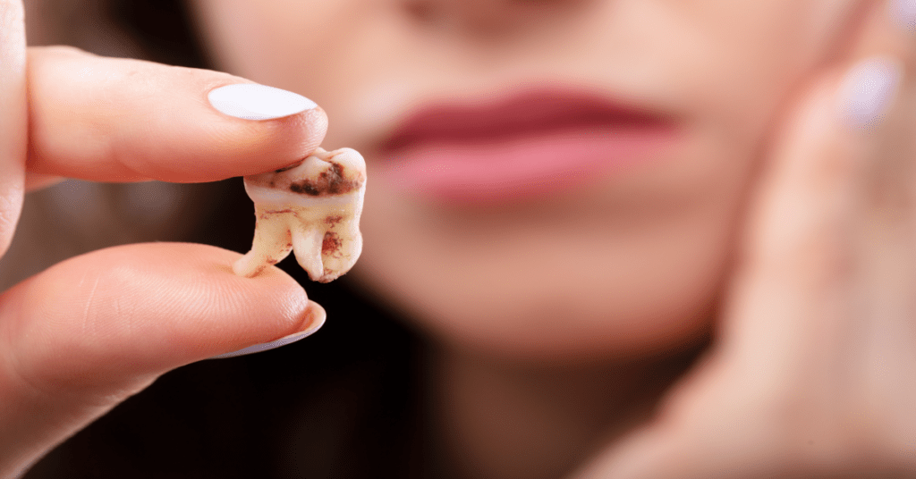 carie-dentara-cabient-stomatologic