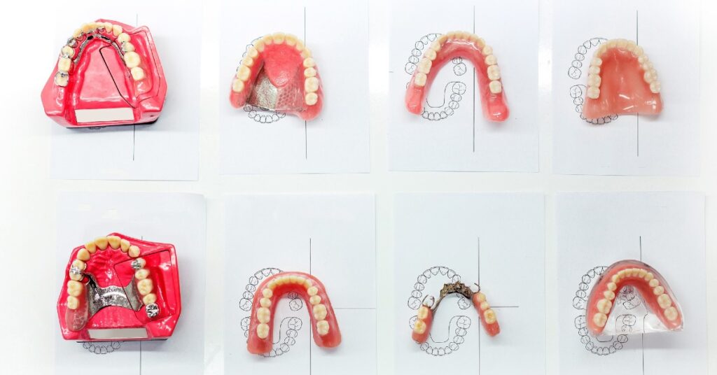 Implanturi dentare disponibile la clinicile Trident
