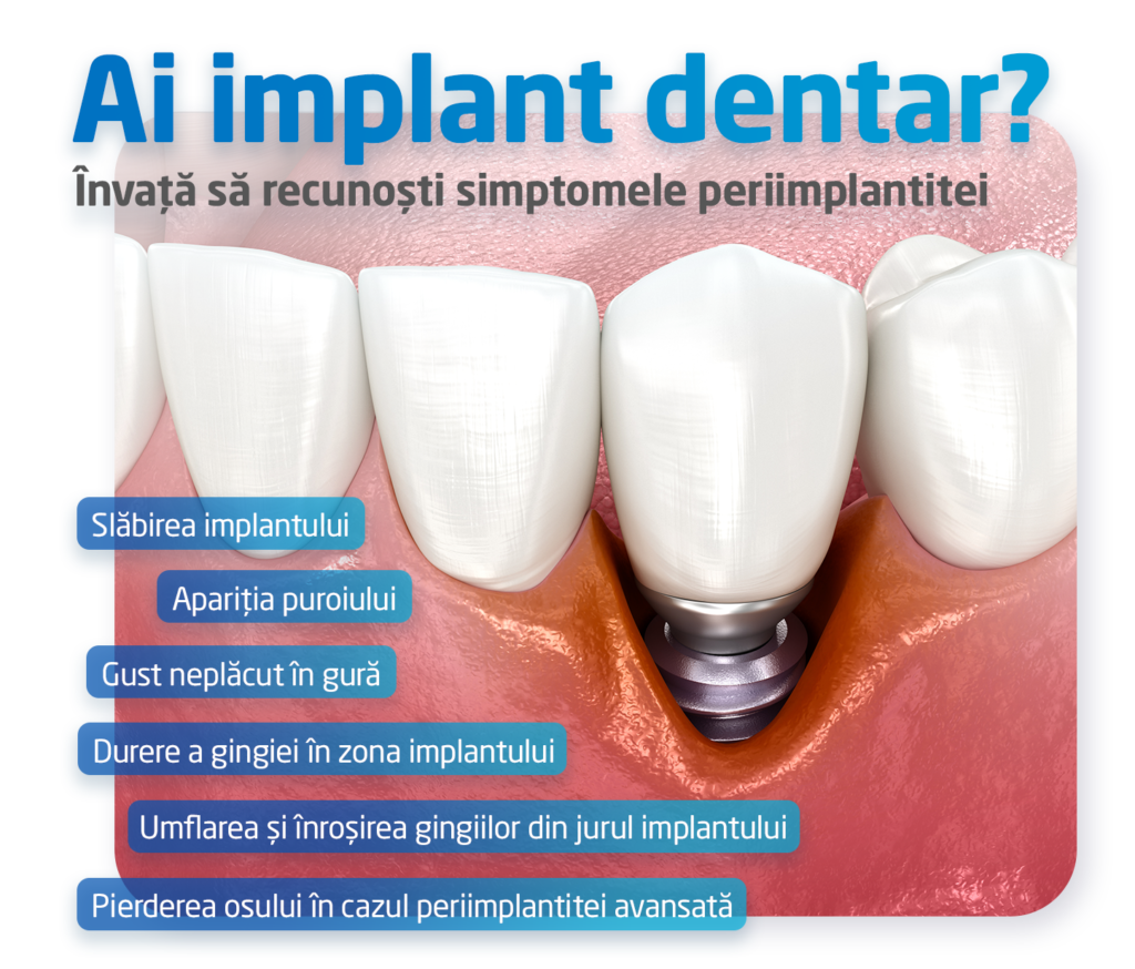 periimplantita simptome infografic
