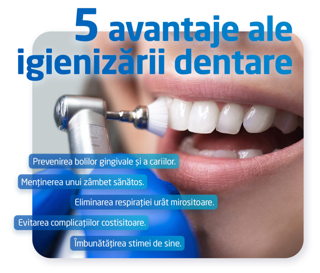 5 avantaje ale igienizarii orale | Trident